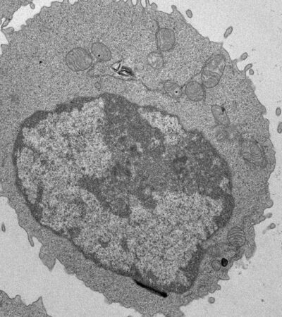 Palmitate-induced mitochondrial damage restricts histone acetylation in CD8 T cells to impair antitumor immunity | Science Immunology