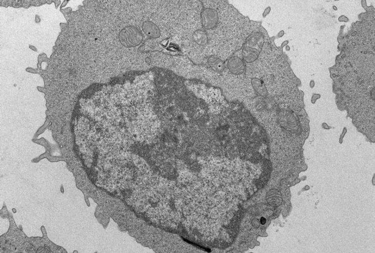 Palmitate-induced mitochondrial damage restricts histone acetylation in CD8 T cells to impair antitumor immunity | Science Immunology