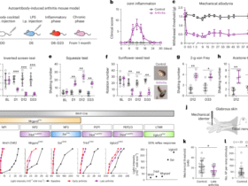 Persistent interferon signaling causes sensory neuron plasticity and pain before and during arthritis