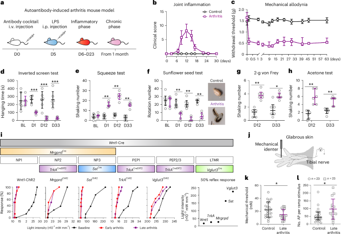 Persistent interferon signaling causes sensory neuron plasticity and pain before and during arthritis