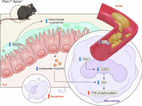 Proline/serine-rich coiled-coil 1 alleviates atherosclerosis via remodeling tryptophan metabolism mediated by Akkermansia muciniphila