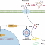 RETN exacerbates sepsis by GBP5/NLRP3 signaling pathway-mediated pyroptosis of macrophage