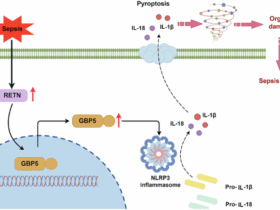 RETN exacerbates sepsis by GBP5/NLRP3 signaling pathway-mediated pyroptosis of macrophage