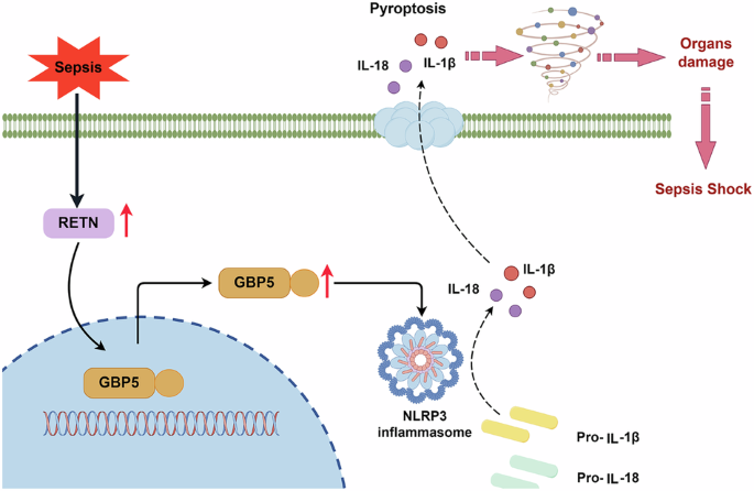RETN exacerbates sepsis by GBP5/NLRP3 signaling pathway-mediated pyroptosis of macrophage