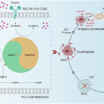 RRx-001 inhibits G6PD to deplete NADPH and trigger disulfidptosis coupled with DAMP-mediated immunogenic cell death in hepatocellular carcinoma