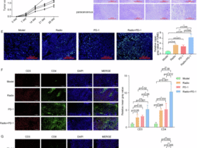 Regulatory mechanisms of ALKBH5/CIITA axis in the synergistic modulation of hepatocellular carcinoma radiotherapy and immunotherapy