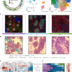 Reprogramming of stroma-derived chemokine networks drives the loss of tissue organization in nodal B cell lymphoma
