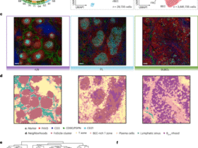Reprogramming of stroma-derived chemokine networks drives the loss of tissue organization in nodal B cell lymphoma