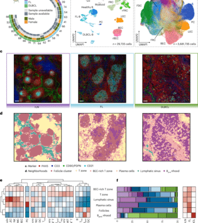 Reprogramming of stroma-derived chemokine networks drives the loss of tissue organization in nodal B cell lymphoma
