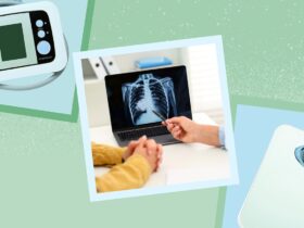 How Rheumatoid Arthritis Affects Life Expectancy