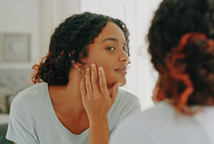 Skin Flaring Up Before A Big Deadline? Science Finally Knows Why