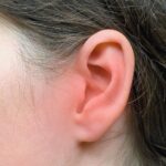 Staph Infection in the Ear: Causes, Symptoms, Treatment