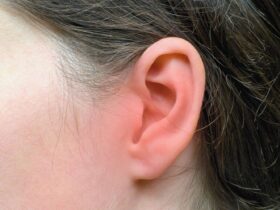 Staph Infection in the Ear: Causes, Symptoms, Treatment
