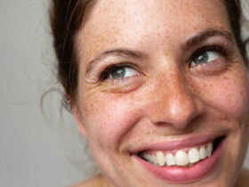 The First Sign Of Skin Aging? What A Mayo Clinic Derm Says