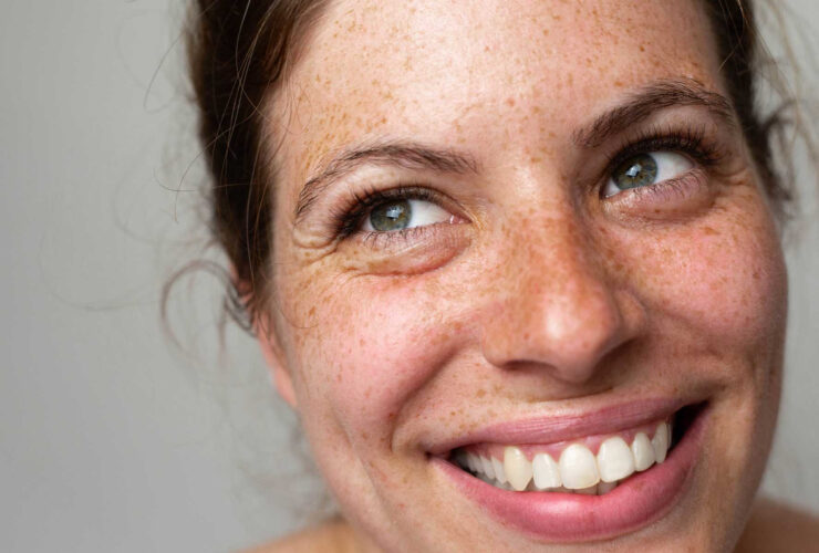 The First Sign Of Skin Aging? What A Mayo Clinic Derm Says