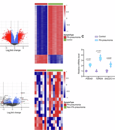 Tudor domain-containing protein 9-targeting siRNA nanoparticles alleviate Pseudomonas aeruginosa lung injury in preclinical models by promoting neutrophil cuproptosis