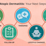Diagnosed With Atopic Dermatitis — What Should I Do Now?