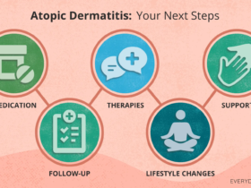 Diagnosed With Atopic Dermatitis — What Should I Do Now?