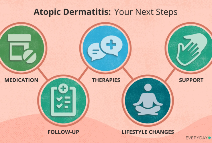 Diagnosed With Atopic Dermatitis — What Should I Do Now?