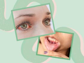 6 Unexpected Signs That Your Crohn’s Is Getting Worse