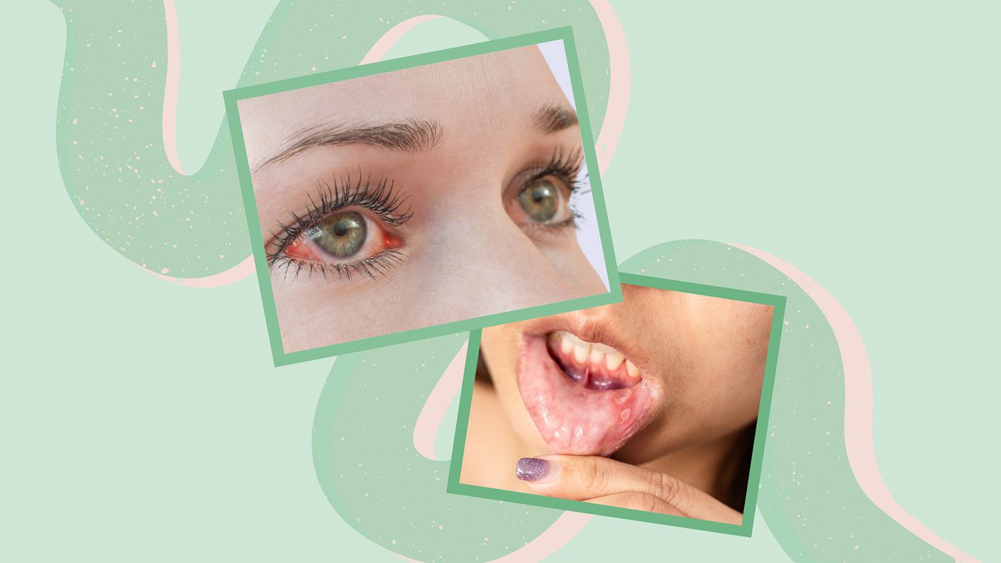 6 Unexpected Signs That Your Crohn’s Is Getting Worse