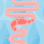 Water for Constipation: Does It Work?