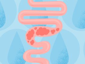 Water for Constipation: Does It Work?