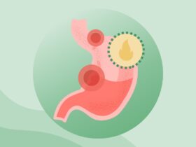 What Are Peptic Ulcers?