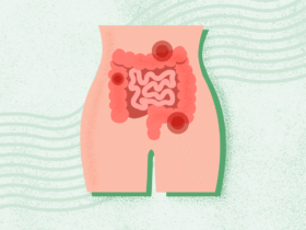 What Is Constipation?