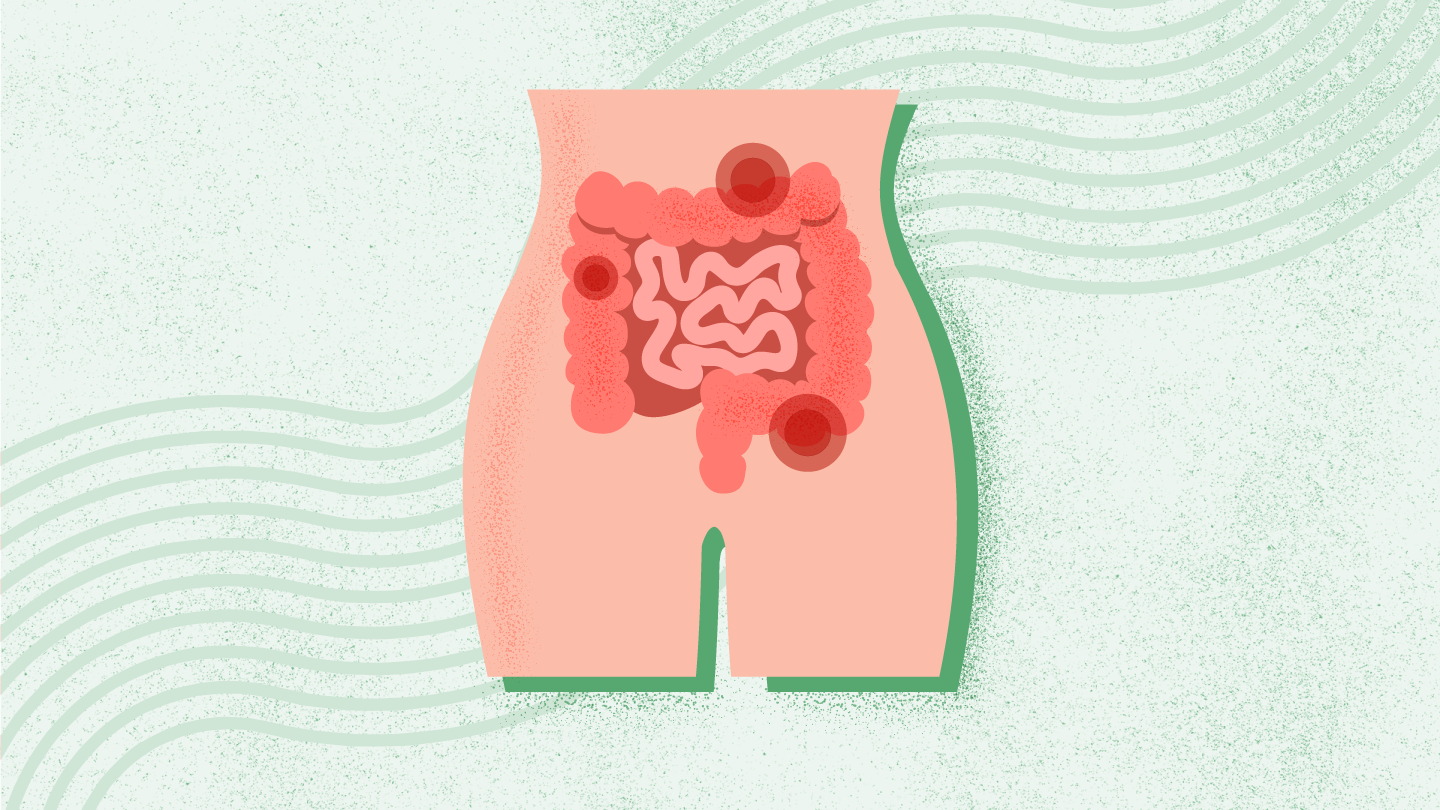 What Is Constipation?