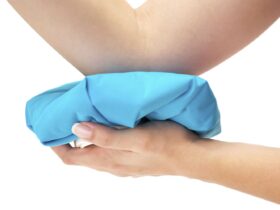 What Is Joint Effusion and How Is It Treated?