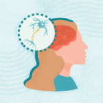 What Is Multiple Sclerosis?