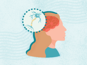 What Is Multiple Sclerosis?