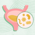 What Is a Urinary Tract Infection (UTI)?