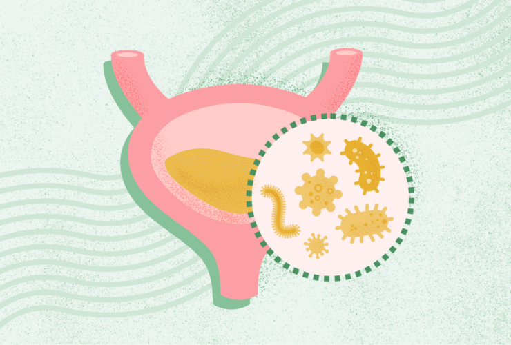 What Is a Urinary Tract Infection (UTI)?