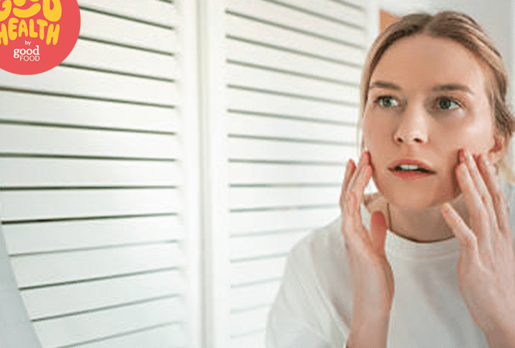 What are the best and worst foods for acne?