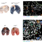 Yin and yang of tumor-associated macrophages