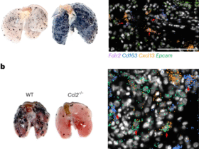 Yin and yang of tumor-associated macrophages