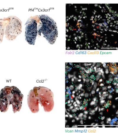 Yin and yang of tumor-associated macrophages