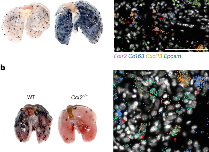 Yin and yang of tumor-associated macrophages
