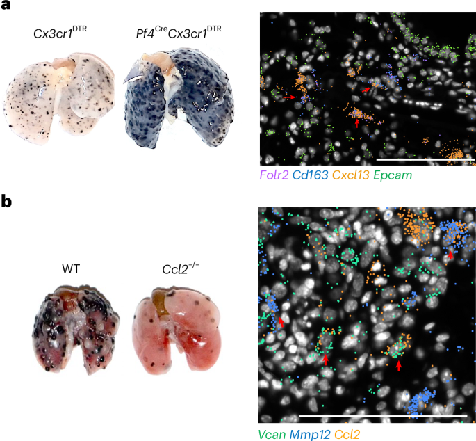 Yin and yang of tumor-associated macrophages
