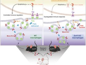 ZNRF1 deficiency disrupts Fas ligand trafficking and immune balance