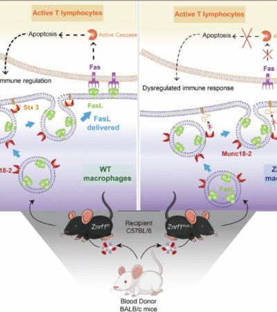 ZNRF1 deficiency disrupts Fas ligand trafficking and immune balance