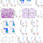 Acute stress alleviates type 2 lung inflammation by restricting ILC2s through corticosterone-glucocorticoid receptor signaling