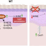 Alox8 knockout exacerbates imiquimod-induced psoriasis-like inflammation