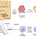 Alternatively activated macrophages cause DNA damage through an arginase 1-mediated bystander effect and promote epithelial cell transformation