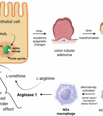 Alternatively activated macrophages cause DNA damage through an arginase 1-mediated bystander effect and promote epithelial cell transformation