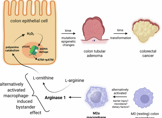 Alternatively activated macrophages cause DNA damage through an arginase 1-mediated bystander effect and promote epithelial cell transformation