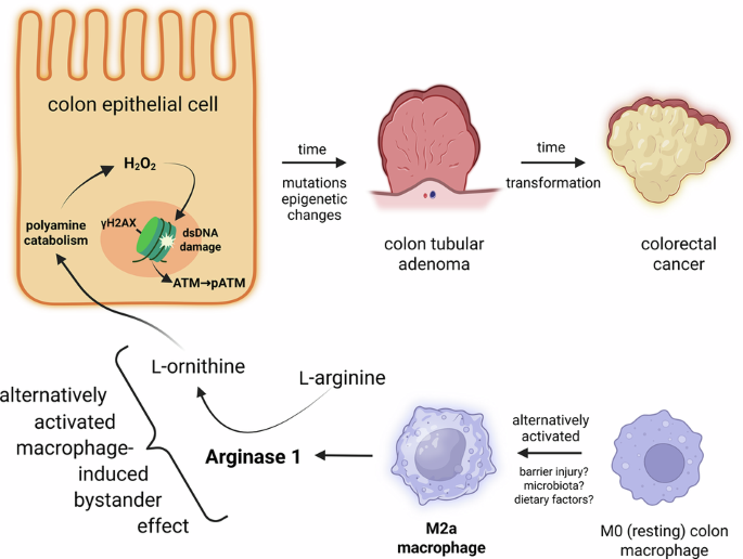 Alternatively activated macrophages cause DNA damage through an arginase 1-mediated bystander effect and promote epithelial cell transformation