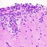 An adaptive cellular source of IL-17A and IL-17F is critical for the induction of experimental autoimmune encephalomyelitis | Science Immunology